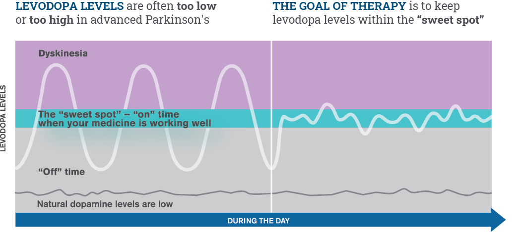 Advanced Parkinson’s On Time Off Time